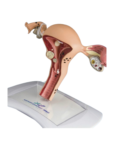 Modello anatomico – art. KM031C