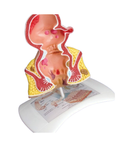 Modello anatomico – art. KM062