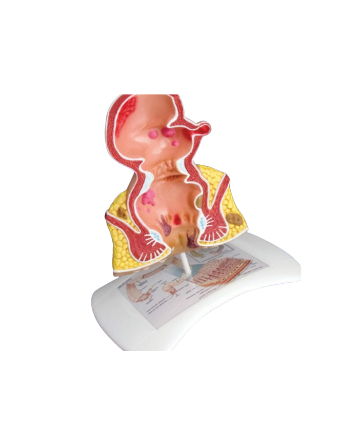 Modello anatomico – art. KM062